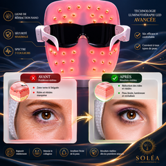Masque de beauté LED rechargeable