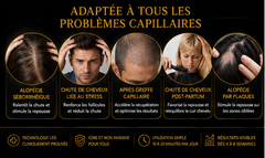 Casque LED Cuir Chevelu Soléa Scalp