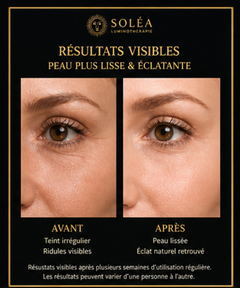 Masque de beauté LED rechargeable